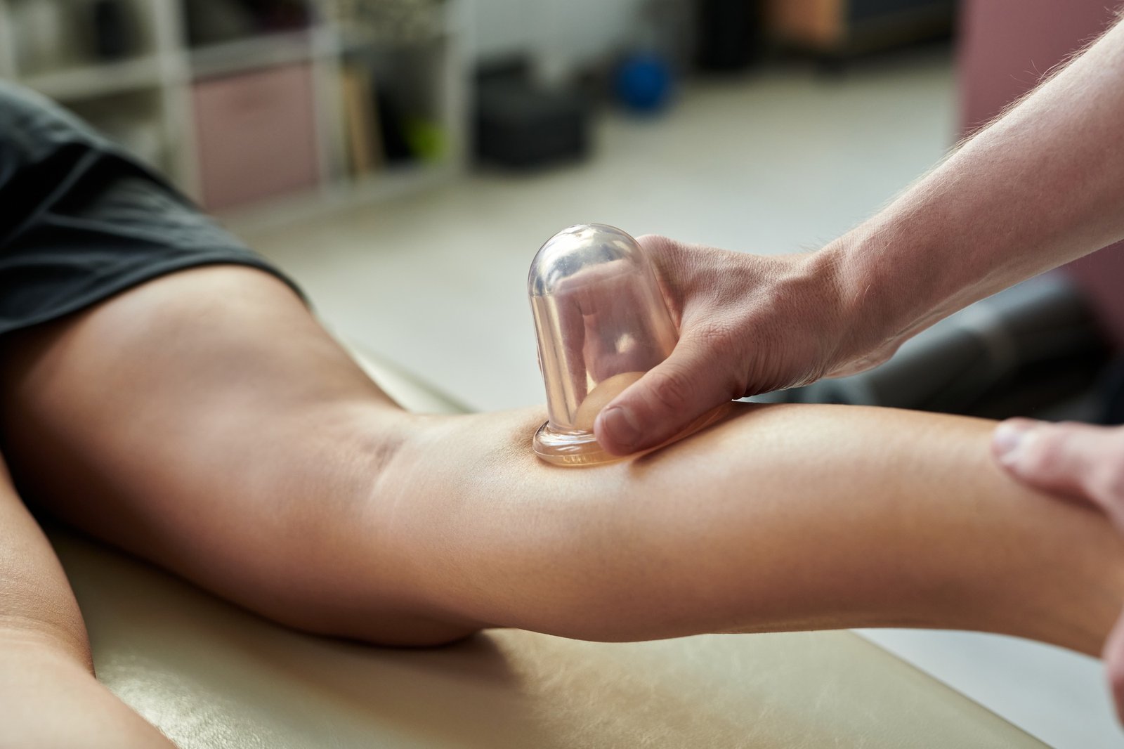 Applying Cupping Therapy on Person's Arm